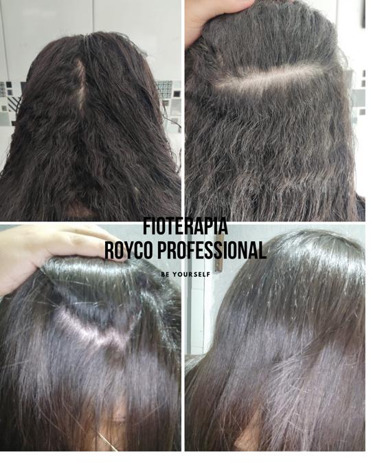 Royco Professional Fioterapia Keratin Hair Treatment Straightening - Brazilian Blowout – 15.9 oz